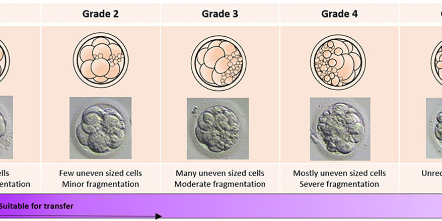 The Art of Embryo grading