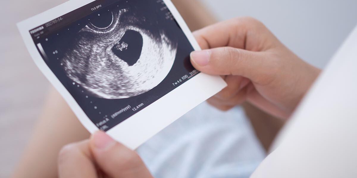 pregnant woman is looking at an ultrasound photo of fetus. Mother gently touches the baby on stomach. Happy, family, growth, pregnancy, enjoyment , prepare newborn, take care, healthcare, tummy.