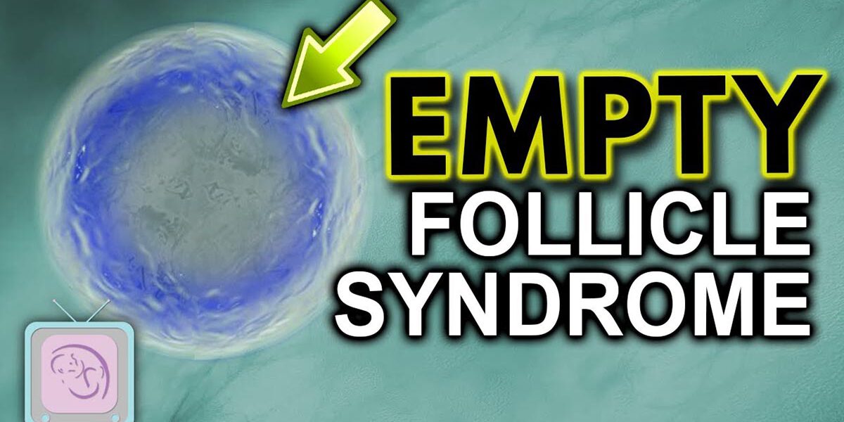 Understanding Empty Follicle Syndrome